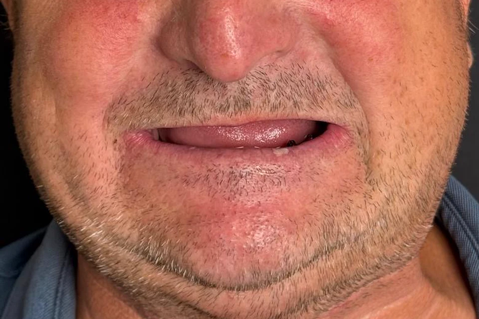 Cazul 5, fotografie înainte, Dentalix