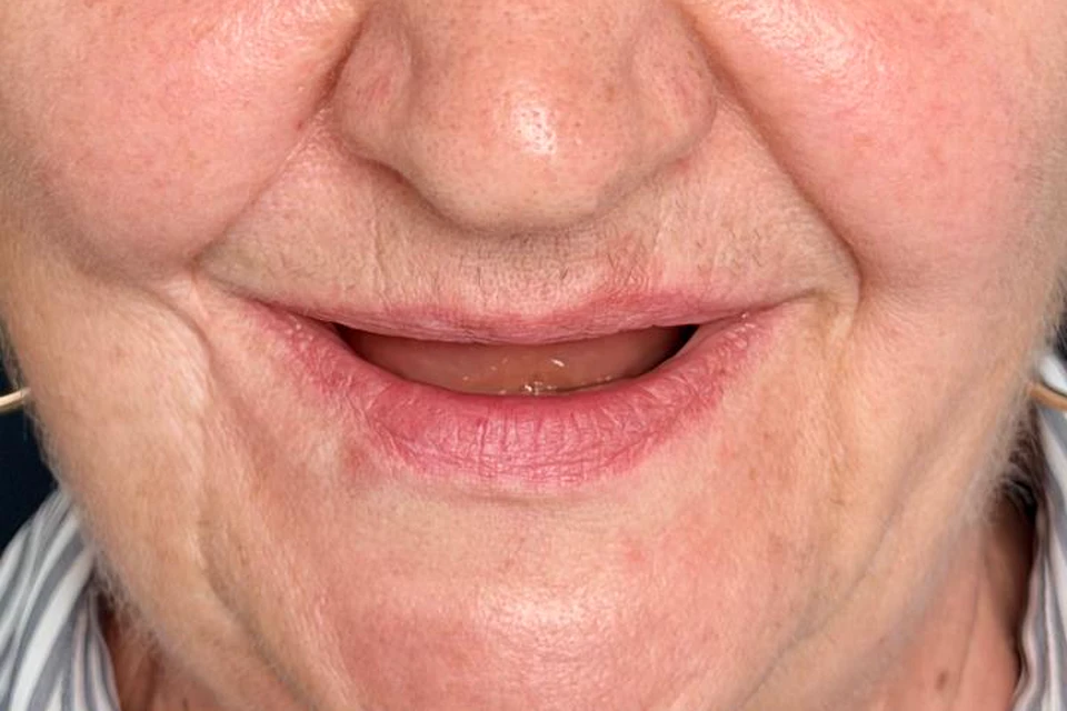 Cazul 2, fotografie înainte, Dentalix