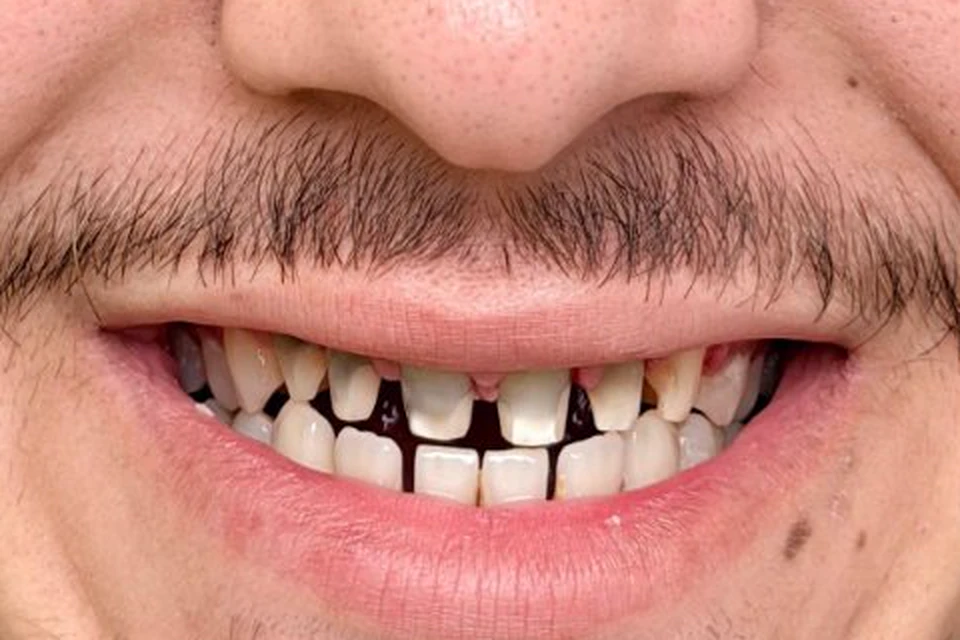 Cazul 7, fotografie înainte, Dentalix